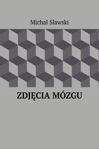 Zdjęcia mózgu