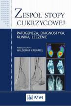 Zespół stopy cukrzycowej. Patogeneza, diagnostyka, klinika, leczenie