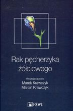 Rak pęcherzyka żółciowego