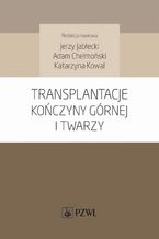 Transplantacje kończyny górnej i twarzy