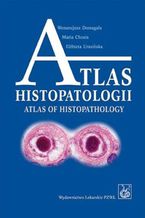 Atlas histopatologii.Tajemniczy wiat chorych komrek czowieka