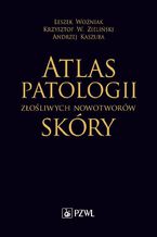 Atlas patologii złośliwych nowotworów skóry