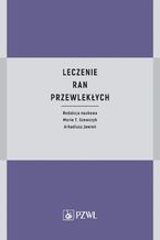 Leczenie ran przewlekłych