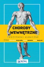 Okładka - Choroby wewnętrzne. Przypadki kliniczne - Artur Mamcarz, Marcin Wełnicki, Wiesława Duda-Król