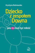 Dziecko z zespołem Downa. Jaka to musi być miłość