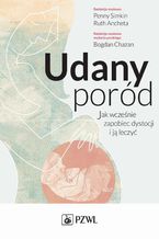 Udany poród. Jak wcześnie zapobiec dystocji i ją leczyć