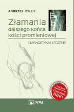 Złamania dalszego końca kości promieniowej. Diagnostyka i leczenie