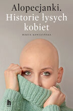 Alopecjanki. Historie ysych kobiet