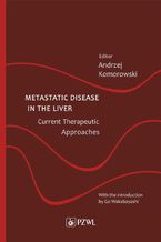 Metastatic Disease in the Liver - Current Therapeutic Approaches