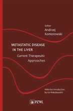 Okadka ksiki Metastatic Disease in the Liver - Current Therapeutic Approaches