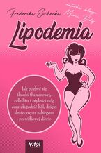 Lipodemia