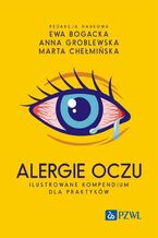 Okadka ksiki Alergie oczu. Ilustrowane kompendium dla praktykw