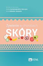 Żywienie w chorobach skóry