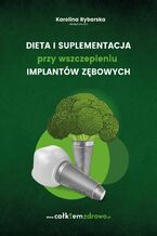 Okładka - Dieta i suplementacja przy wszczepieniu implantów zębowych - Karolina Rybarska