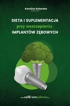 Okadka ksiki Dieta i suplementacja przy wszczepieniu implantw zbowych