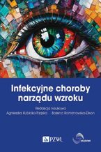 Okładka - Infekcyjne choroby narządu wzroku - Bożena Romanowska-Dixon, Agnieszka Kubicka-Trząska