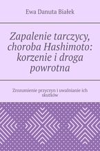 Okładka - Zapalenie tarczycy, choroba Hashimoto: korzenie i droga powrotna - Ewa Białek