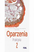 Okładka - Oparzenia. Praktyka tom 2 - Jerzy Strużyna, Agnieszka Surowiecka, Tomasz Korzeniowski