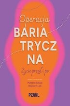 Okładka - Operacja bariatryczna. Życie przed i po - Marzena Sekuła, Wojciech Lisik