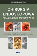 Okładka - Chirurgia endoskopowa pola żółciowo-trzustkowego - Mateusz Jagielski
