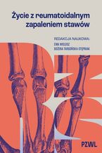 Okładka - Życie z reumatoidalnym zapaleniem stawów - Ewa Wielosz, Bożena Targońska-Stępniak