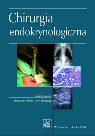 Okładka książki/ebooka Chirurgia endokrynologiczna