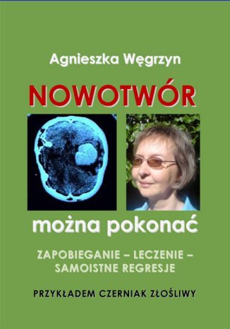 Nowotwór można pokonać