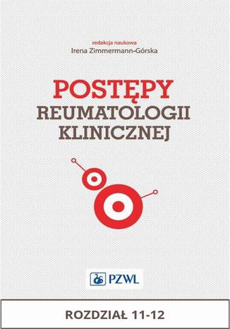 Postpy reumatologii klinicznej. Rozdzia 11-12 Irena Zimmermann-Grska - okadka audiobooka MP3