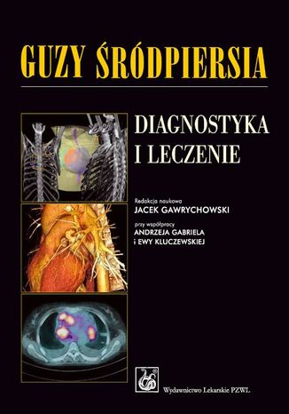 Guzy śródpiersia. Diagnostyka i leczenie