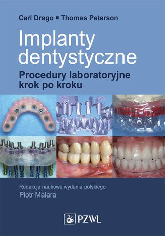 Implanty dentystyczne. Procedury laboratoryjne krok po kroku Carl Drago, Thomas Peterson - okadka ebooka