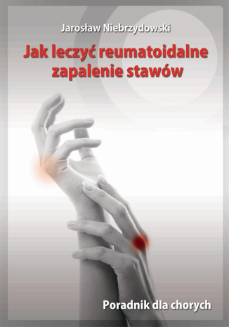 Okładka: Jak leczyć reumatoidalne zapalenie stawów. Poradnik dla chorych
