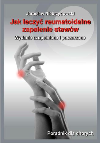 Okładka: Jak leczyć reumatoidalne zapalenie stawów II