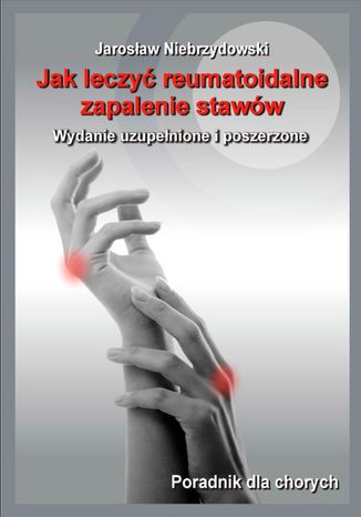 Jak leczyć reumatoidalne zapalenie stawów II Jarosław Niebrzydowski - okładka ebooka