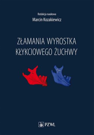Okładka książki/ebooka Złamania wyrostka kłykciowego żuchwy