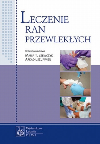 Leczenie ran przewlekych Maria T. Szewczyk - okadka audiobooks CD