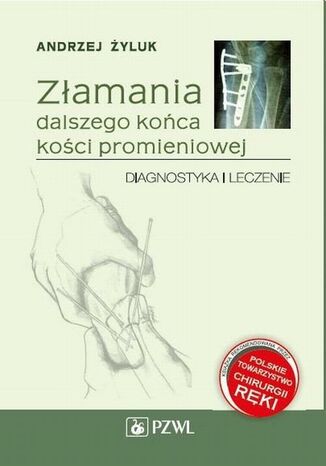 Złamania dalszego końca kości promieniowej