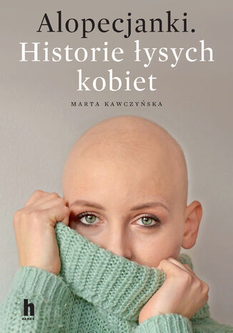 Alopecjanki. Historie ysych kobiet Marta Kawczyska - okadka ebooka
