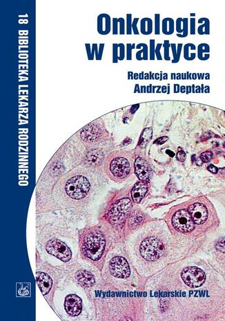 Onkologia w praktyce
