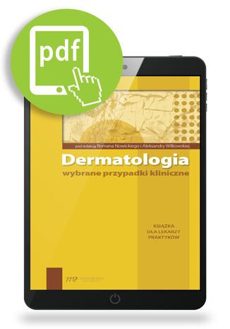 Dermatologia - wybrane przypadki kliniczne 