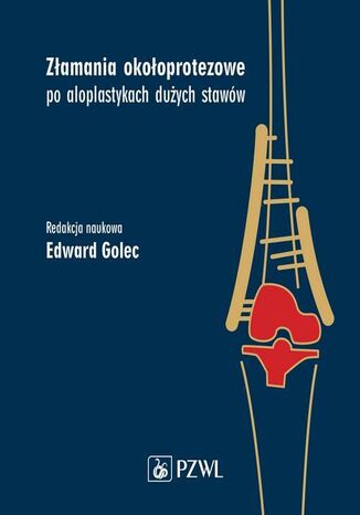 Zamania okooprotezowe po aloplastykach duych staww Edward Golec - okadka audiobooka MP3