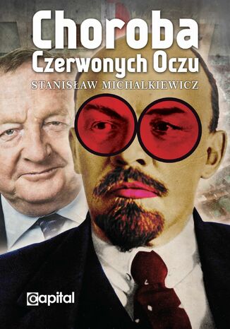 Choroba czerwonych oczu  Stanisław Michalkiewicz - okładka audiobooka MP3