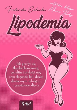 Lipodemia