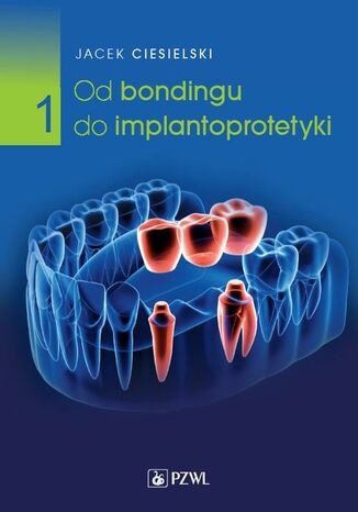 Od bondingu do implantoprotetyki Część 1