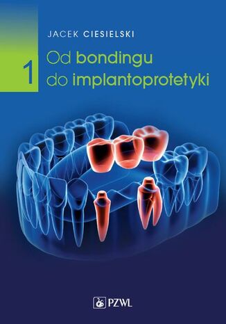 Od bondingu do implantoprotetyki Cz 1 Jacek Ciesielski - okadka ebooka