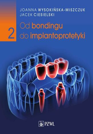 Od bondingu do implantoprotetyki Cz 2 Jacek Ciesielski, Joanna Wysokiska-Miszczuk - okadka audiobooks CD