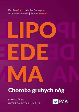 Lipoedema Karolina Ch, Monika Domagaa, Artur Mieczkowski, Dorota Stettler - okadka audiobooka MP3
