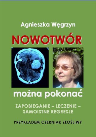 Nowotwór można pokonać Agnieszka Węgrzyn - okladka książki
