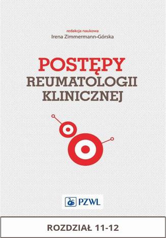 Postępy reumatologii klinicznej. Rozdział 11-12 Irena Zimmermann-Górska - okladka książki