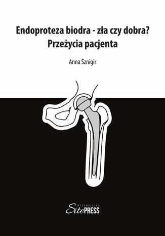 Endoproteza biodra  zła czy dobra? Przeżycia pacjenta Anna Sznigir - okladka książki