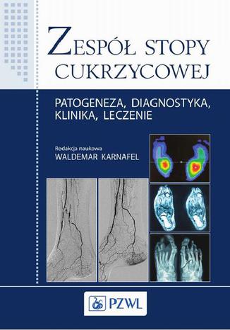 Zespół stopy cukrzycowej. Patogeneza, diagnostyka, klinika, leczenie Waldemar Karnafel - okladka książki